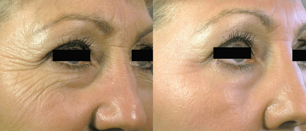 Skincare Guide facial at Pure MedSpa in Woodinville