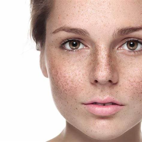 Skin Pigmentation & Sun Damage