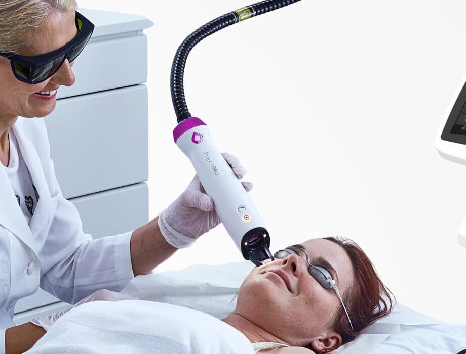 Fractional Laser Resurfacing